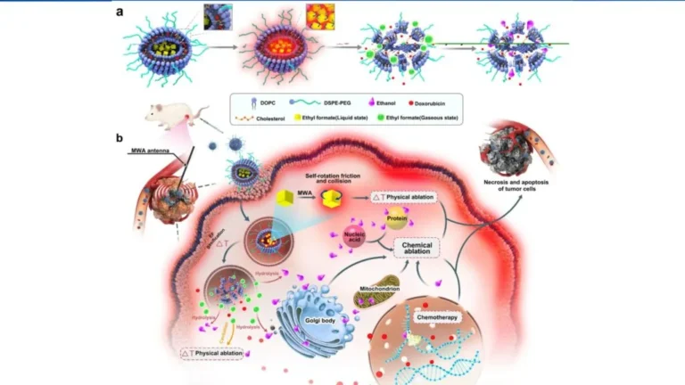 Microwave Ablation (MWA)​