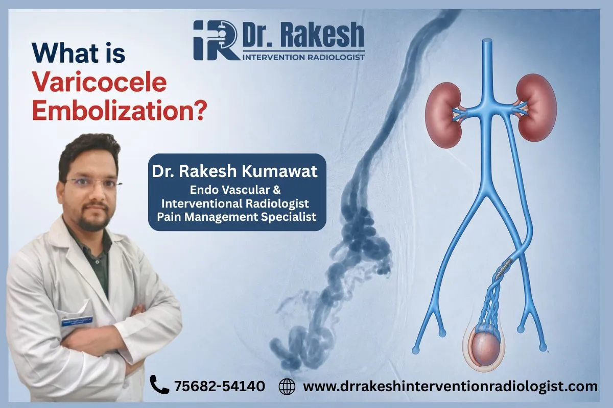 Dr. Rakesh Kumawat explaining varicocele embolization treatment in Jaipur with medical illustration of varicocele veins and embolization procedure for non-surgical varicocele treatment in Rajasthan.