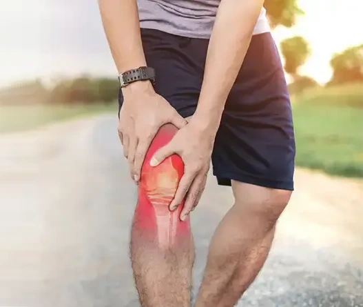 Genicular Artery Embolization