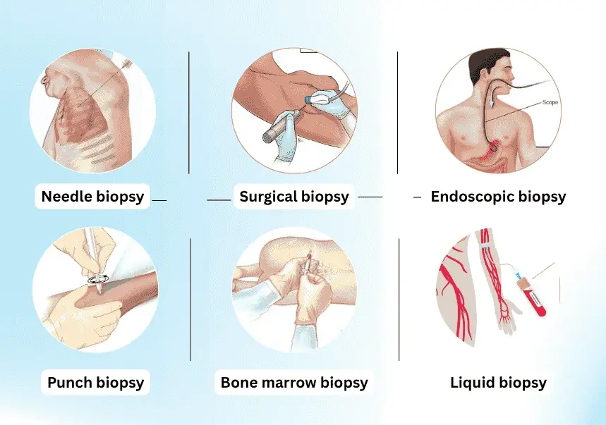 Biopsy Testing Centre