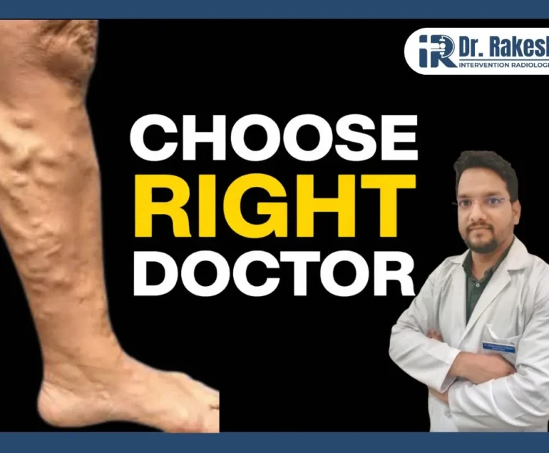 Common Mistakes to Avoid When Selecting a Vein Specialist