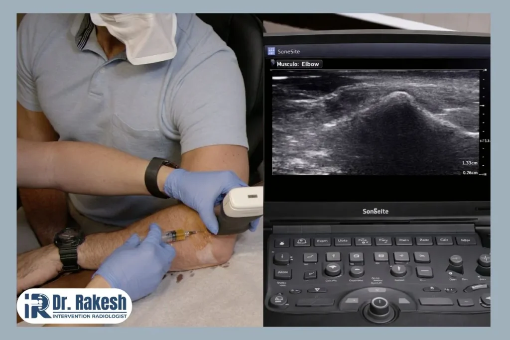 Non-Surgical Pain Relief Treatments