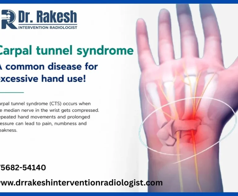 Best NonSurgical Treatments for Wrist Pain Carpal Tunnel Syndrome Advanced Effective Minimally Invasive Options