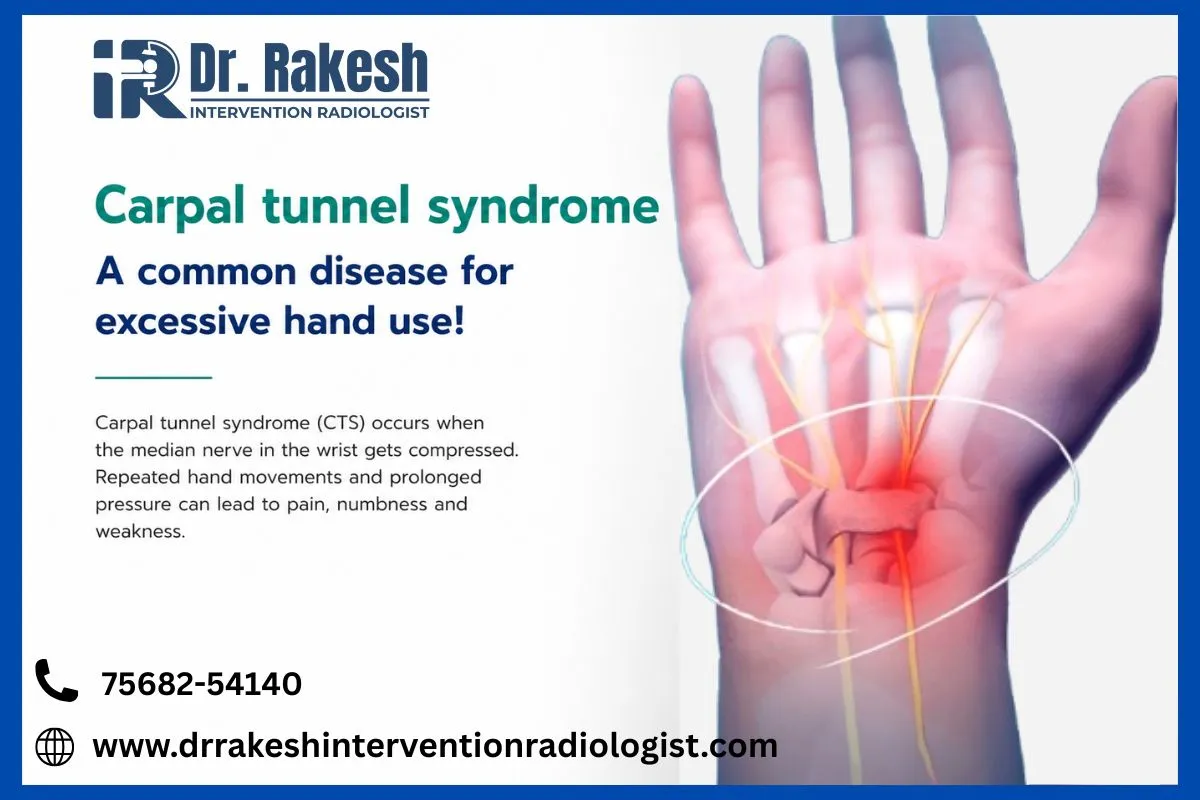 Best NonSurgical Treatments for Wrist Pain Carpal Tunnel Syndrome Advanced Effective Minimally Invasive Options