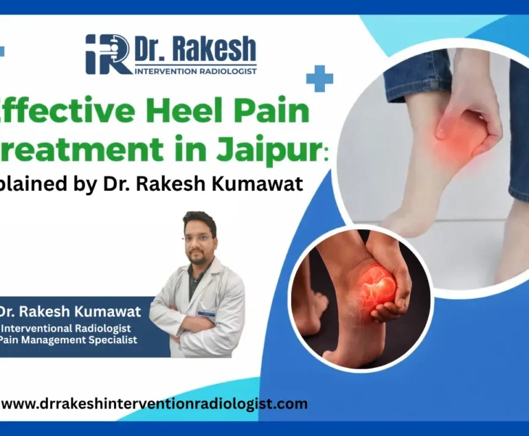 Complete Guide to Heel Pain Treatment Causes Symptoms