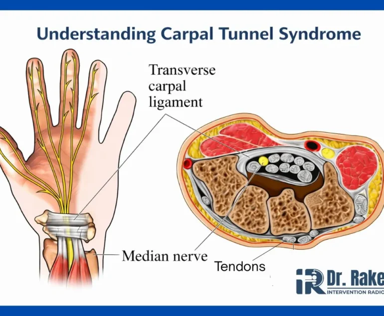 How to Relieve Wrist Pain Naturally Medically Complete Guide for Fast Relief
