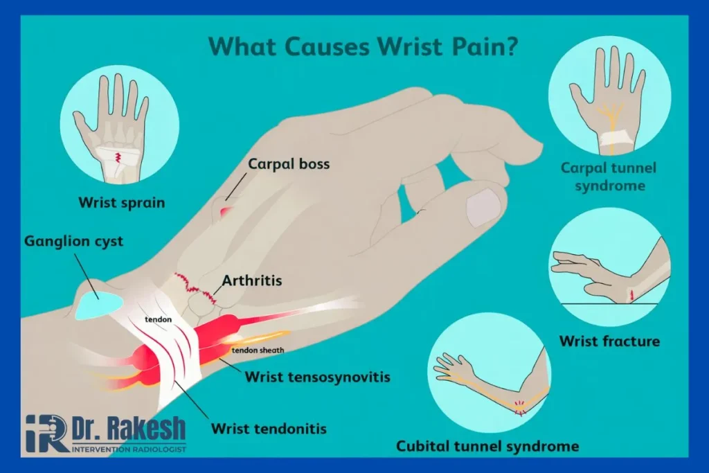 How to Relieve Wrist Pain Naturally Medically Complete Guide for Fast Relief