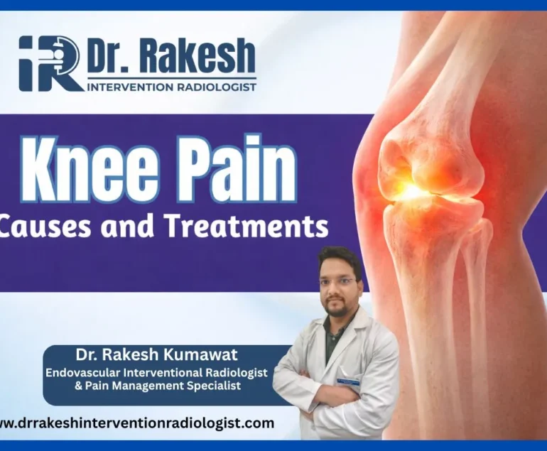 Knee Pain When Should You Visit a Specialist Warning Signs You Shouldn’t Ignore