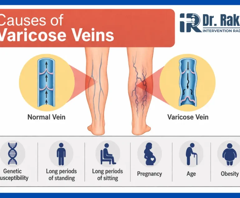 Varicose Vein Doctor vs Vascular Surgeon Who Should You Consult .