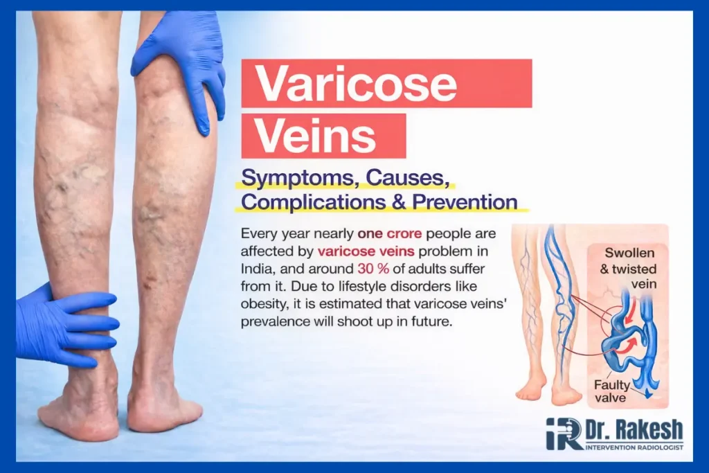 Varicose Vein Doctor vs Vascular Surgeon Who Should You Consult