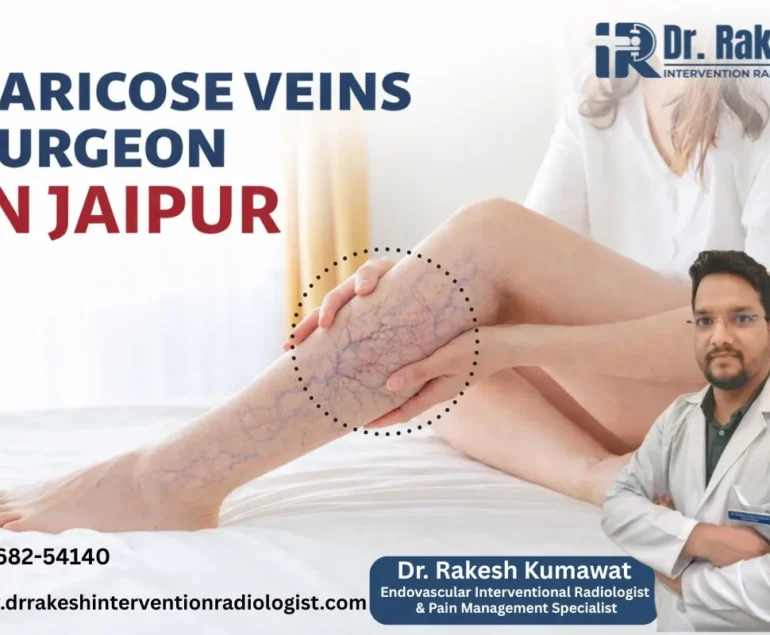 Varicose Vein Surgeon in Jaipur Treatment Options Recovery Time Complete Guide.