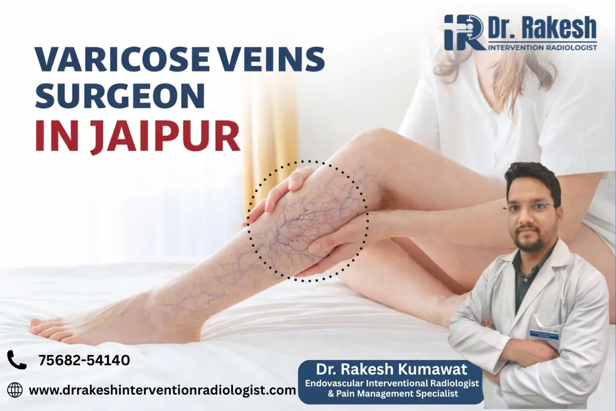 Varicose Vein Surgeon in Jaipur Treatment Options Recovery Time Complete Guide.