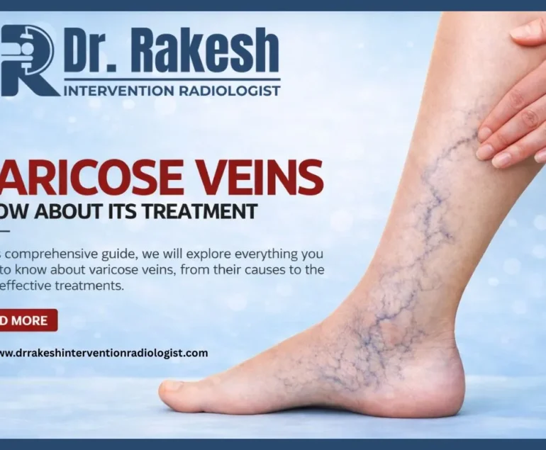 varicose vein doctor vs vascular surgeon