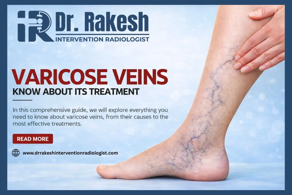 varicose vein doctor vs vascular surgeon