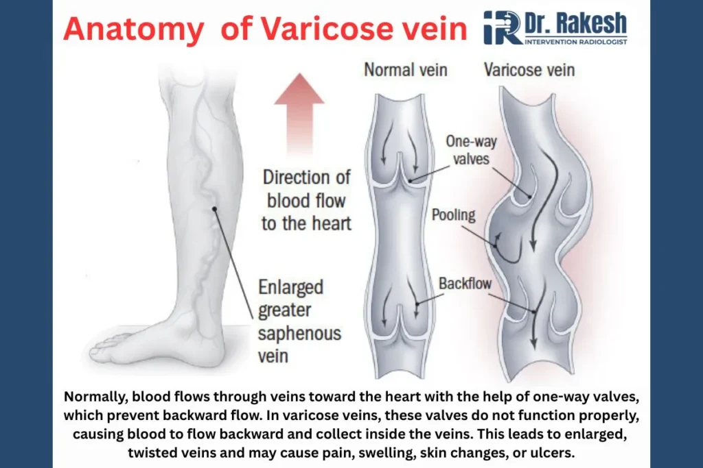 varicose vein doctor vs vascular surgeon