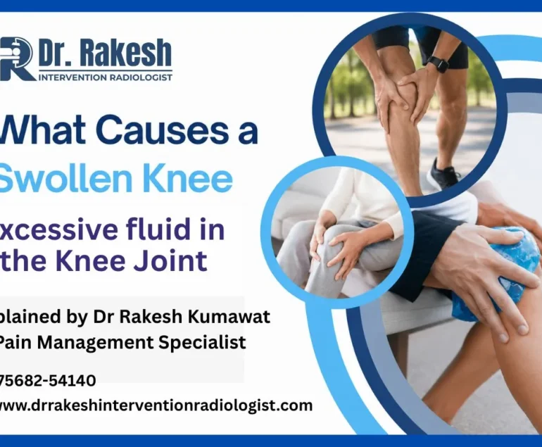 When Knee Pain and Leg Swelling Happen Together What It Means.