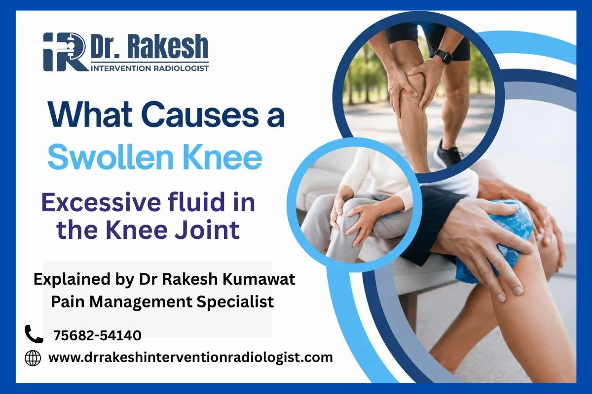 When Knee Pain and Leg Swelling Happen Together What It Means.