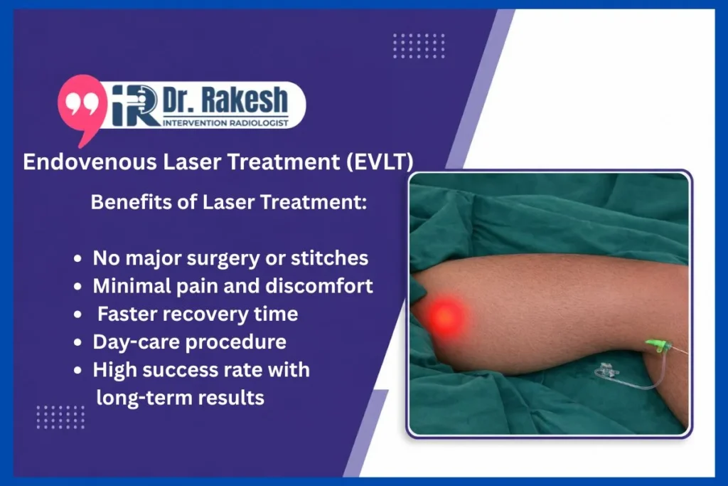 Which Doctor to Consult for Varicose Veins in Jaipur