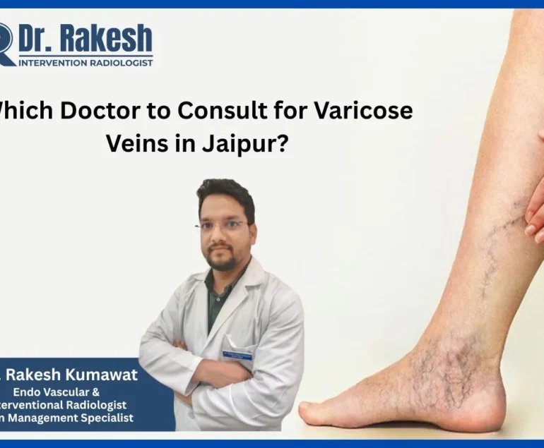 Which Doctor to Consult for Varicose Veins in Jaipur