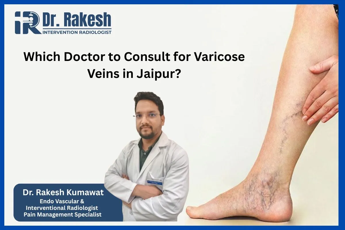 Which Doctor to Consult for Varicose Veins in Jaipur