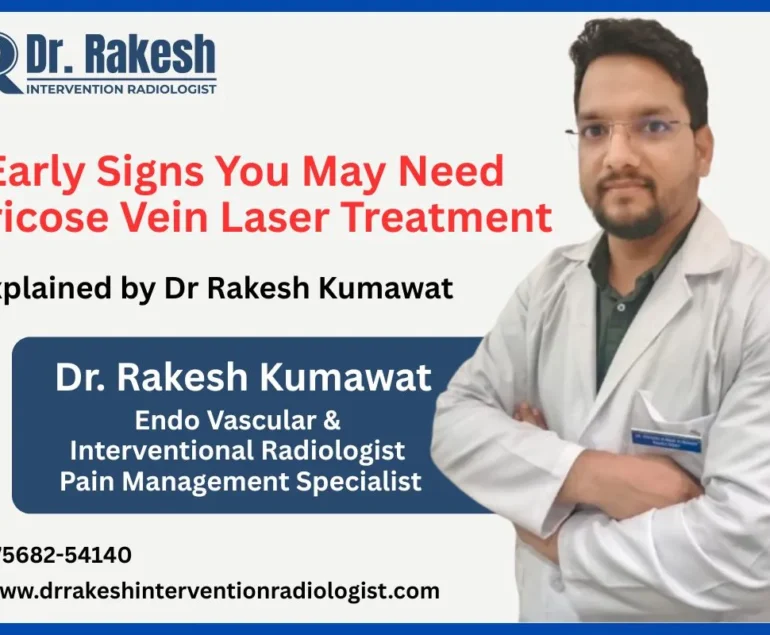 Early Signs You May Need Varicose Vein Laser Treatment