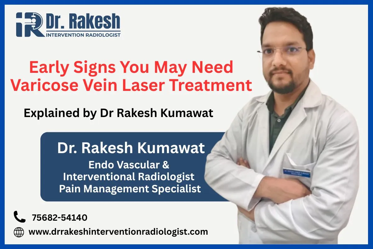 Early Signs You May Need Varicose Vein Laser Treatment