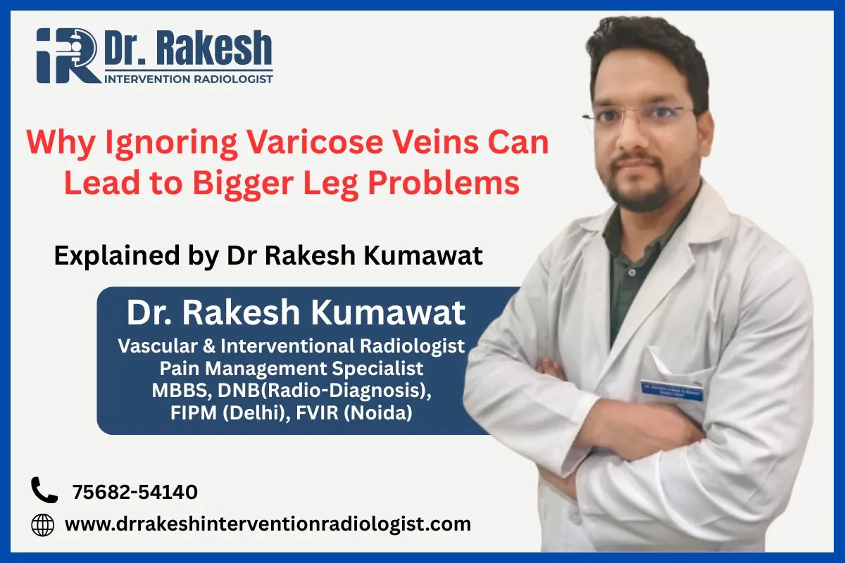 Why Ignoring Varicose Veins Can Lead to Bigger Leg Problems