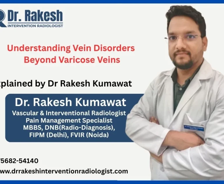 Understanding Vein Disorders Beyond Varicose Veins
