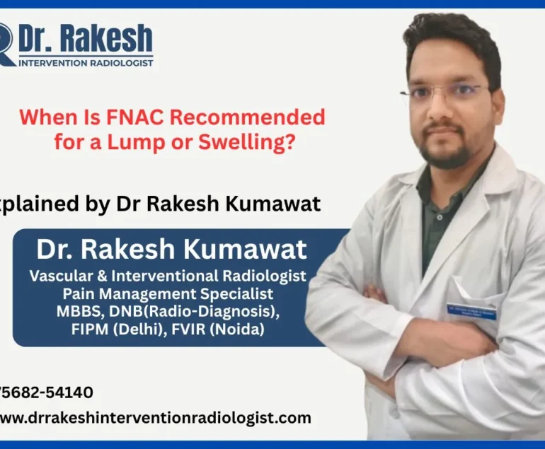 When Is FNAC Recommended for a Lump or Swelling