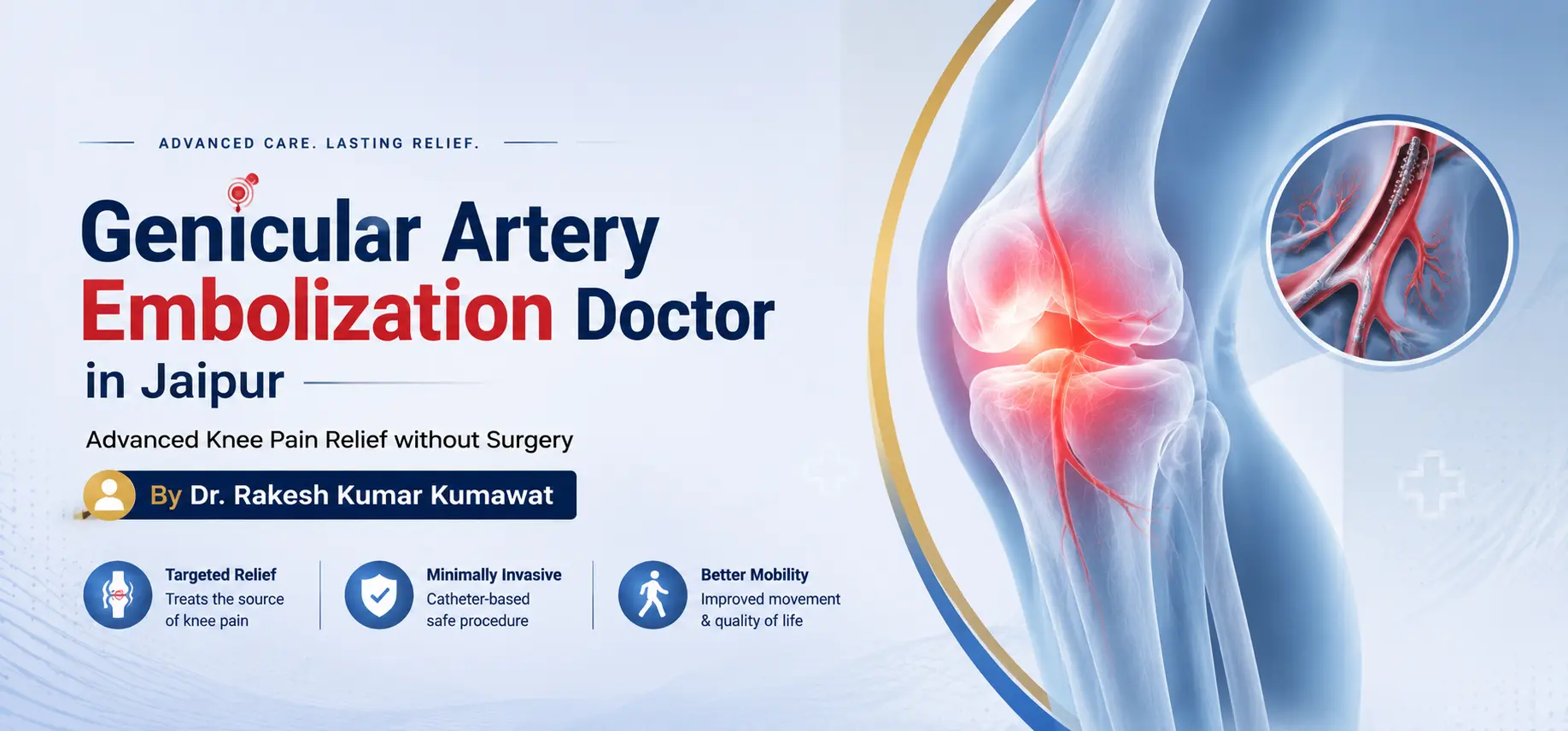 Genicular Artery Embolization Doctor