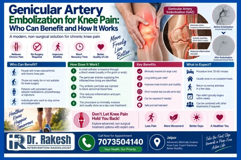 Genicular Artery Embolization for Knee Pain Who Can Benefit and How It Works