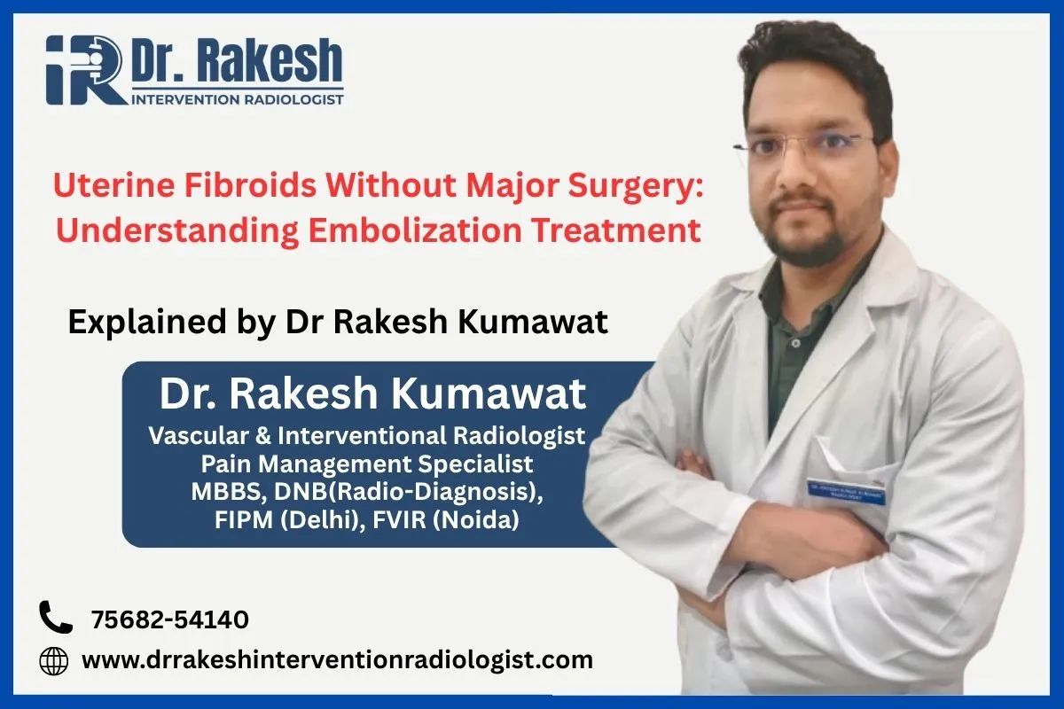 Uterine Fibroids Without Major Surgery Understanding Embolization Treatment